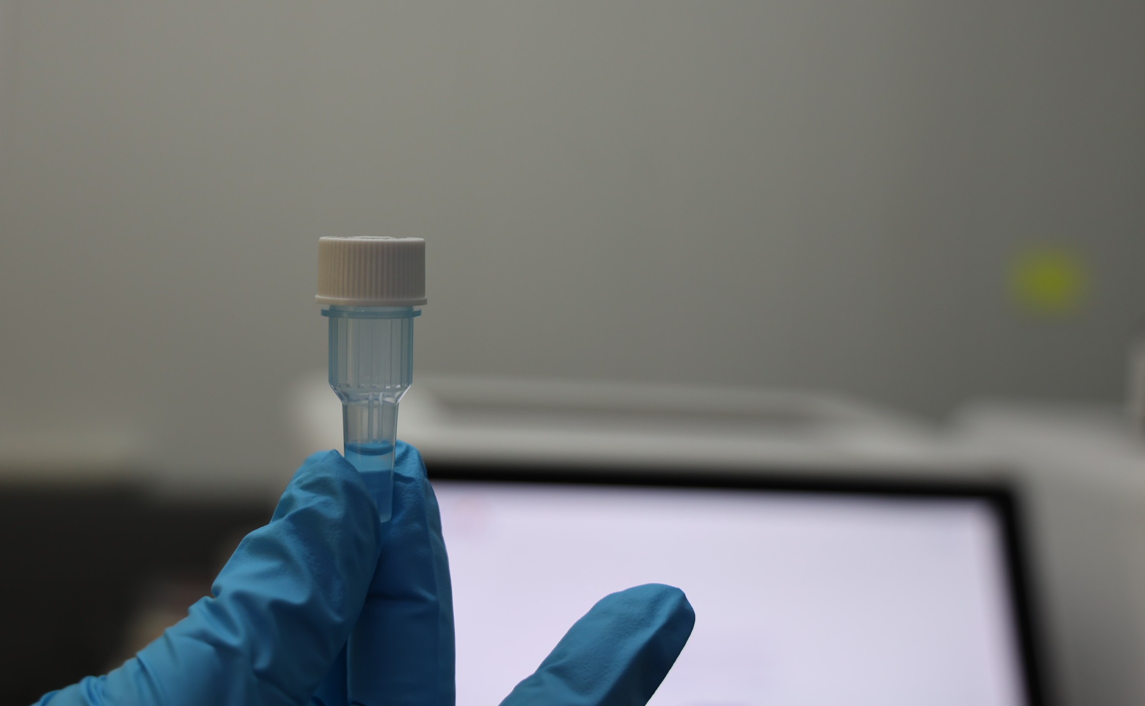 A gloved hand holding a diagnostic sample vial